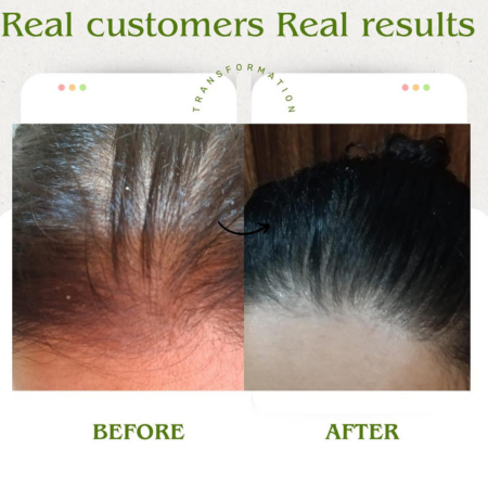 4- Month Visible Hair Growth Plan (100ml × 4) Best Value Pack