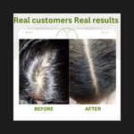 Load image into Gallery viewer, QiRah 3-Month Hair Repair Plan (100 ml × 3) 🔥 Best Value Pack – Save More Every Month