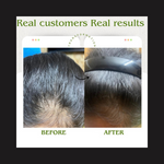 Load image into Gallery viewer, QiRah 3-Month Hair Repair Plan (100 ml × 3) 🔥 Best Value Pack – Save More Every Month