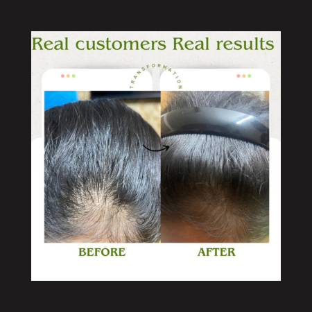 QiRah 3-Month Hair Repair Plan (100 ml × 3) 🔥 Best Value Pack – Save More Every Month