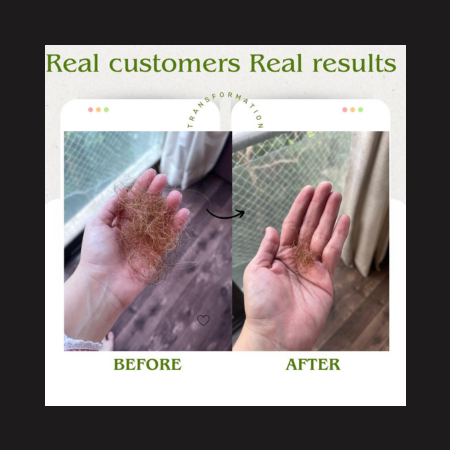 QiRah Hair Growth Oil – Bestseller (Pack of 2 | 100ml each)