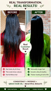 QiRah Hair Fall Control + Faster Growth Complete Kit (Oil + Shampoo + Conditioner + Comb) ⭐️Best Seller| 🚚 Free Delivery