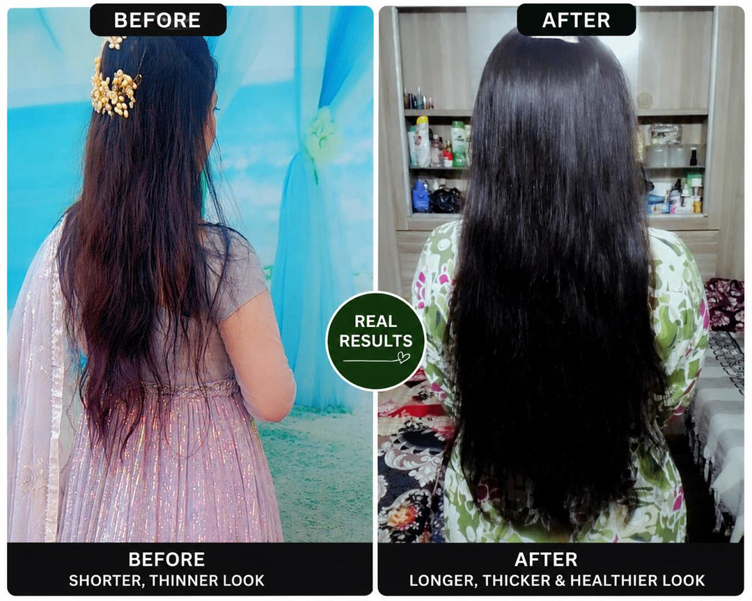 QiRah Hair Fall Control + Faster Growth Complete Kit (Oil + Shampoo + Conditioner + Comb) ⭐️Best Seller| 🚚 Free Delivery