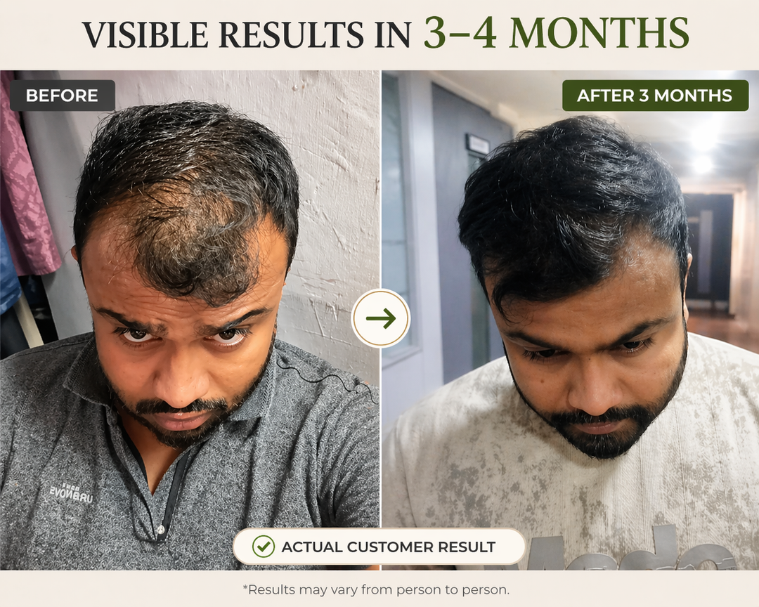 QiRah Hair Fall Control + Faster Growth Complete Kit (Oil + Shampoo + Conditioner + Comb)