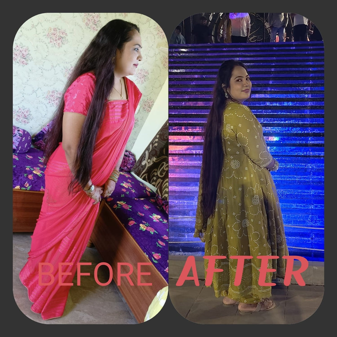 QiRah Complete Hair Repair System (4 to 5 Months Repair Plan)