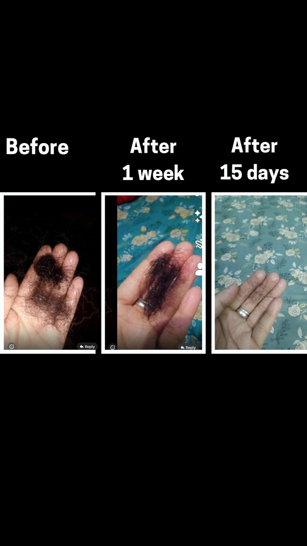 QiRah Hair Growth Oil – Bestseller (Pack of 2 | 100ml each)